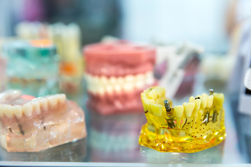 What is the Difference between a Dentist and an Oral Surgeon?