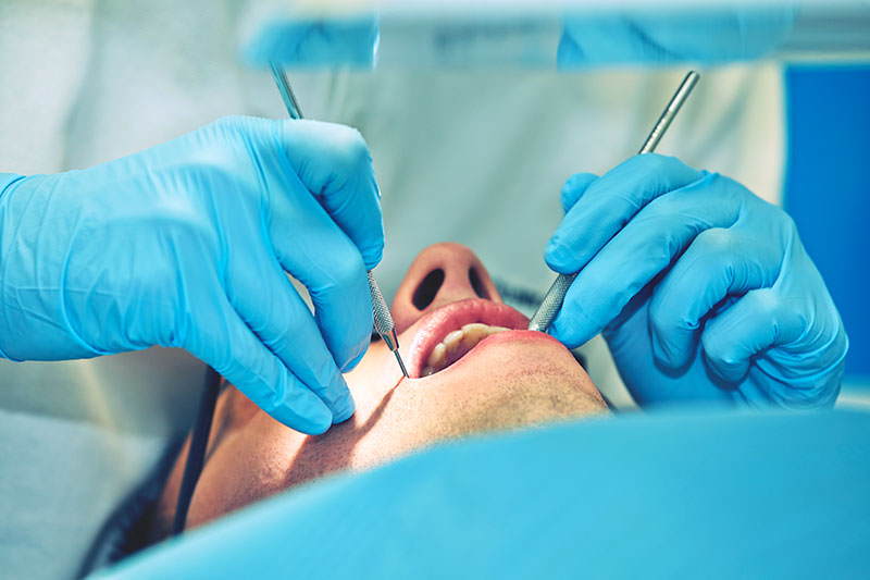 What to Expect after Wisdom Teeth Removal