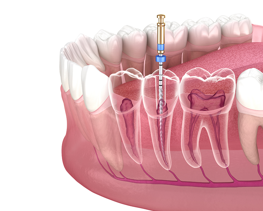 Leading Oral Surgeon For Dental Infections | Frisco, TX