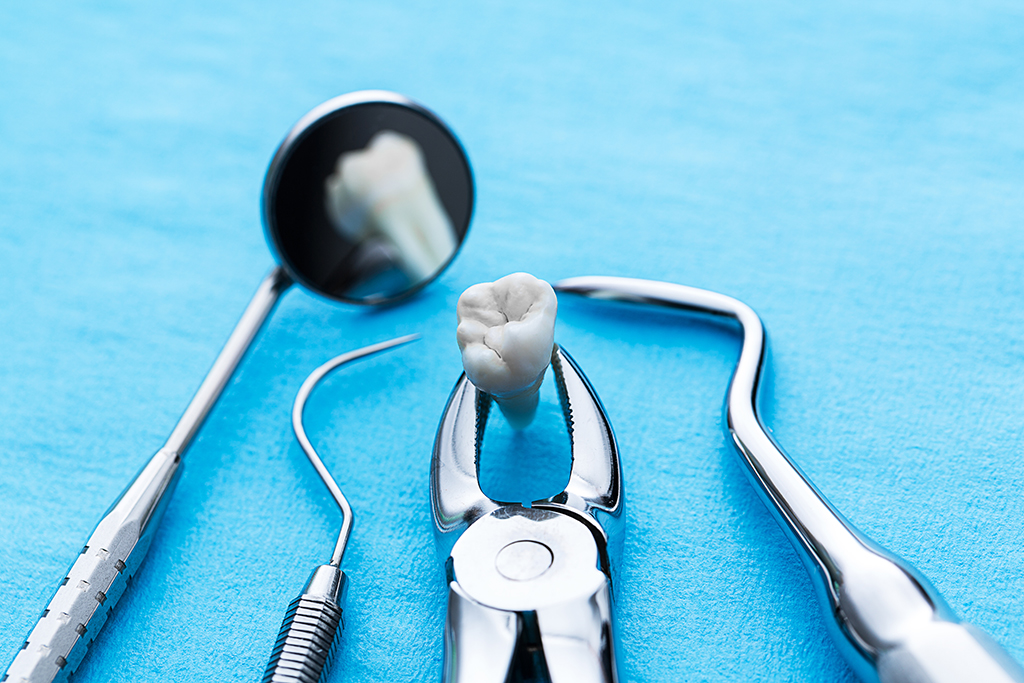 Talented Oral Surgeon For Wisdom Teeth Removal | Frisco, TX